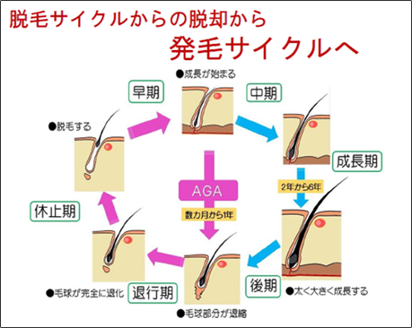 脱毛サイクルからの脱却から発毛サイクルへ