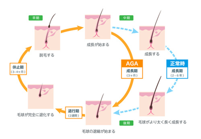毛周期サイクル