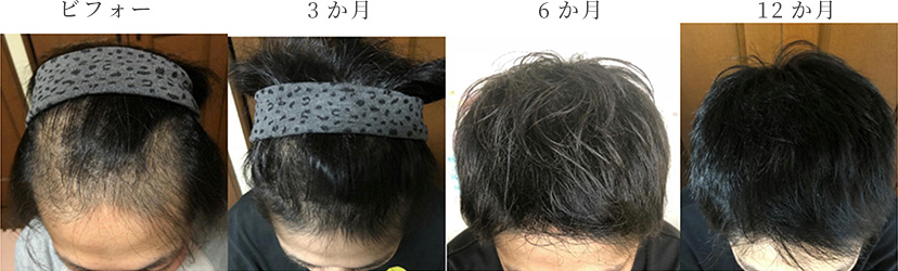30代男性 1年間（3か月毎）