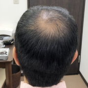 カウンセリング時